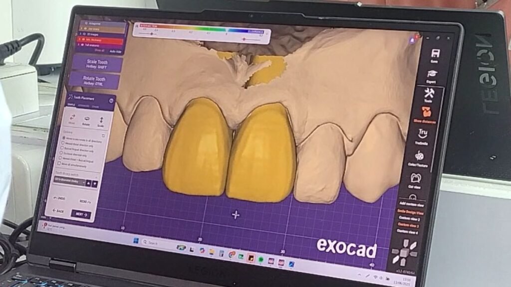 Desain Digital (CAD)