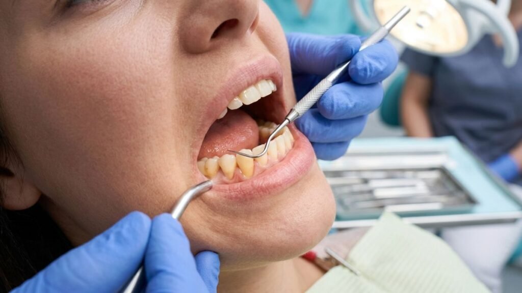 pemeriksaan gigi sensitif di Klinik Dental 21 PIK