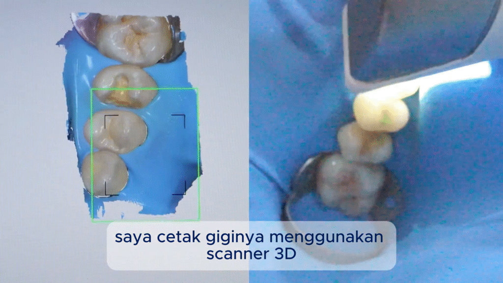 Penggunaan Scanner 3D