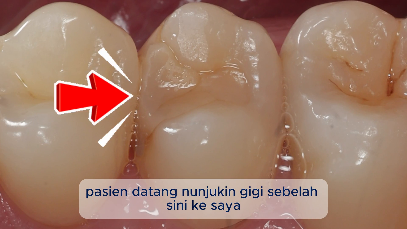 Kondisi Gigi Bermasalah